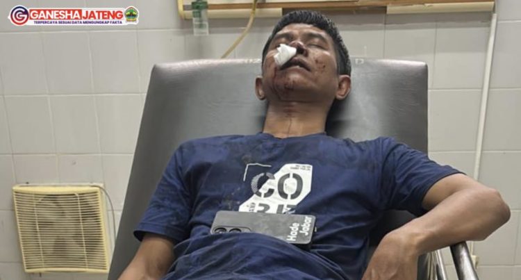 Wartawan Hadejabar Menjadi Korban Pengeroyokan Delapan Orang Preman, Saat Bertugas. Wartawan Hadejabar Menjadi Korban Pengeroyokan Delapan Orang Preman, Saat Bertugas.